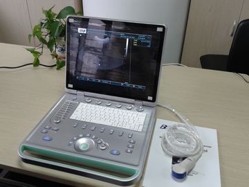 الكمبيوتر المحمول الرقمية 3D الموجات فوق الصوتية المحمولة الماسح الضوئي مع جميع أنواع التحقيق